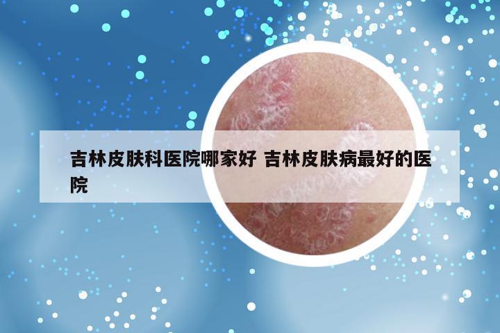 吉林皮肤科医院哪家好 吉林皮肤病最好的医院