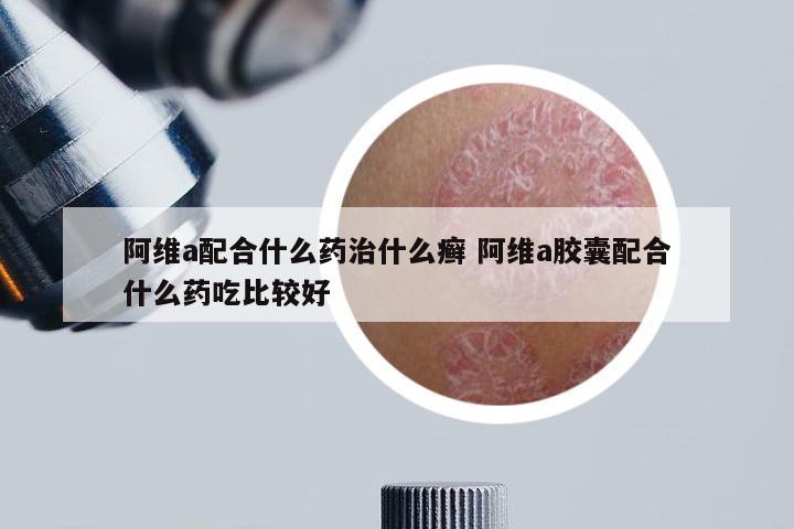阿维a配合什么药治什么癣 阿维a胶囊配合什么药吃比较好