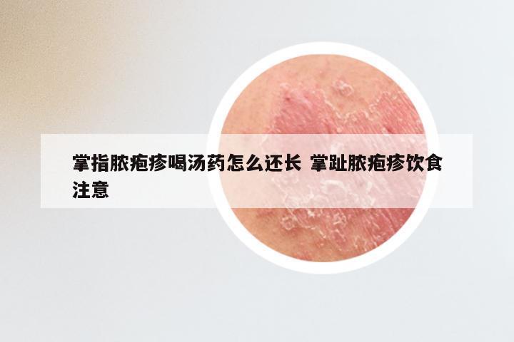 掌指脓疱疹喝汤药怎么还长 掌趾脓疱疹饮食注意