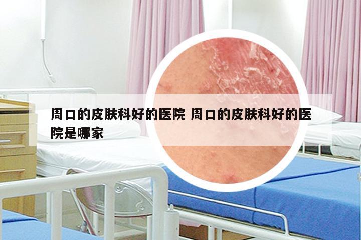 周口的皮肤科好的医院 周口的皮肤科好的医院是哪家