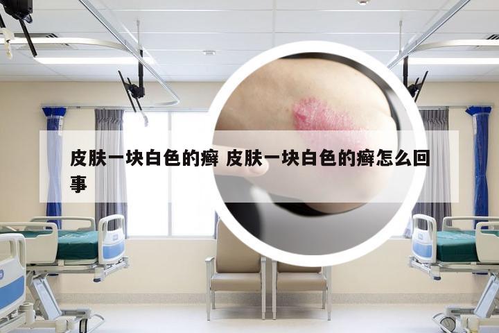 皮肤一块白色的癣 皮肤一块白色的癣怎么回事