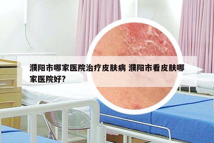 濮阳市哪家医院治疗皮肤病 濮阳市看皮肤哪家医院好?