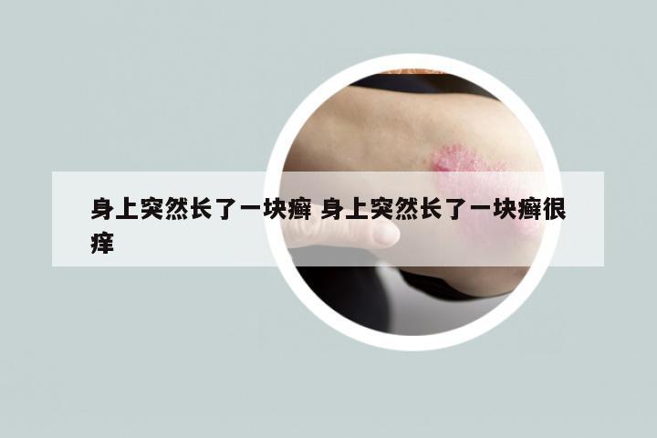 身上突然长了一块癣 身上突然长了一块癣很痒