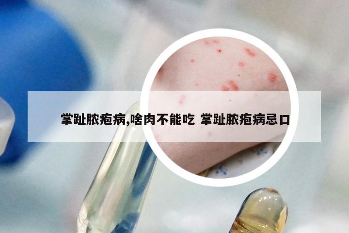 掌趾脓疱病,啥肉不能吃 掌趾脓疱病忌口