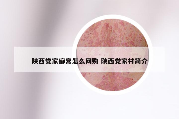 陕西党家癣膏怎么网购 陕西党家村简介
