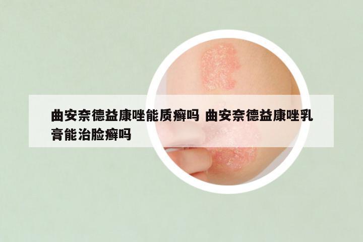 曲安奈德益康唑能质癣吗 曲安奈德益康唑乳膏能治脸癣吗