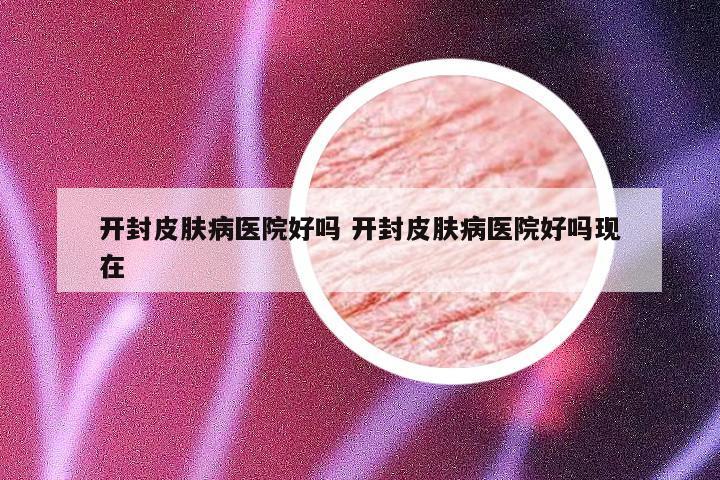 开封皮肤病医院好吗 开封皮肤病医院好吗现在
