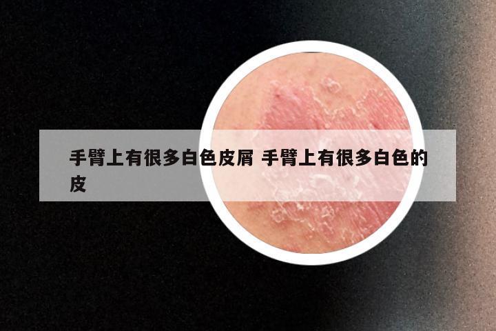 手臂上有很多白色皮屑 手臂上有很多白色的皮
