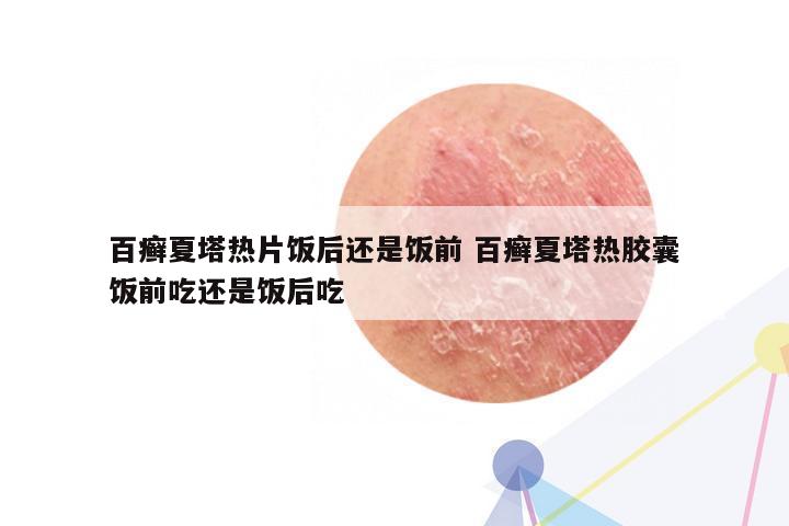 百癣夏塔热片饭后还是饭前 百癣夏塔热胶囊饭前吃还是饭后吃