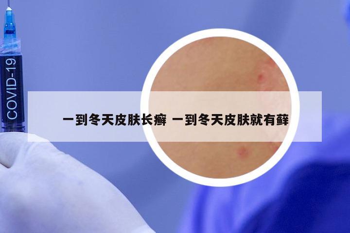 一到冬天皮肤长癣 一到冬天皮肤就有藓