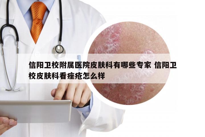 信阳卫校附属医院皮肤科有哪些专家 信阳卫校皮肤科看痤疮怎么样