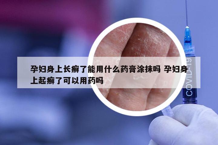孕妇身上长癣了能用什么药膏涂抹吗 孕妇身上起癣了可以用药吗