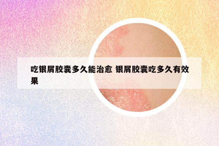 吃银屑胶囊多久能治愈 银屑胶囊吃多久有效果
