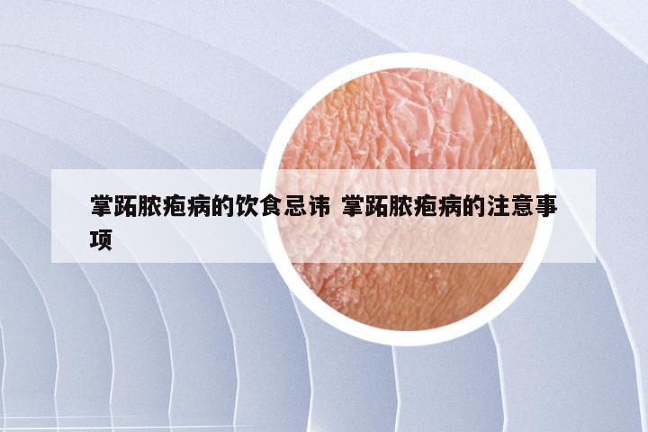 掌跖脓疱病的饮食忌讳 掌跖脓疱病的注意事项