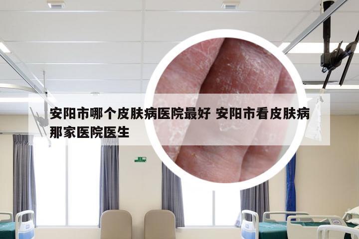 安阳市哪个皮肤病医院最好 安阳市看皮肤病那家医院医生