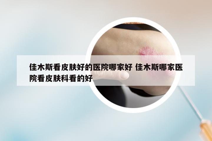佳木斯看皮肤好的医院哪家好 佳木斯哪家医院看皮肤科看的好