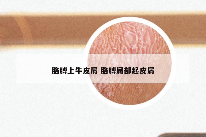 胳膊上牛皮屑 胳膊局部起皮屑