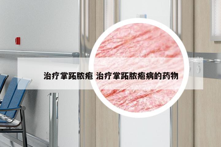 治疗掌跖脓疱 治疗掌跖脓疱病的药物