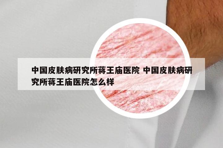 中国皮肤病研究所蒋王庙医院 中国皮肤病研究所蒋王庙医院怎么样