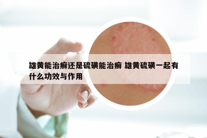雄黄能治癣还是硫磺能治癣 雄黄硫磺一起有什么功效与作用