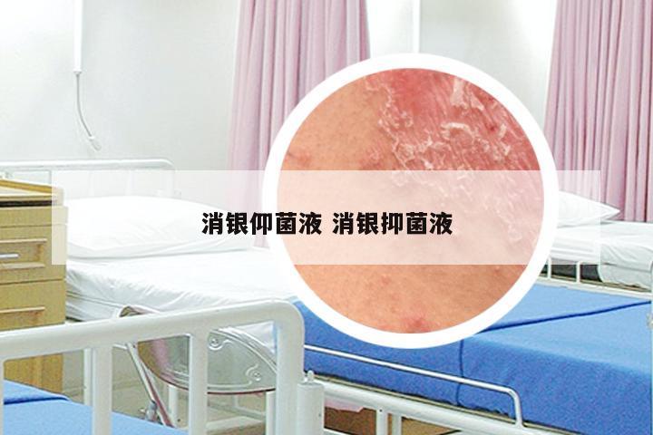 消银仰菌液 消银抑菌液