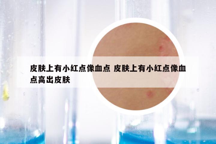 皮肤上有小红点像血点 皮肤上有小红点像血点高出皮肤