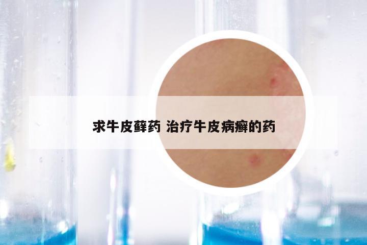 求牛皮藓药 治疗牛皮病癣的药
