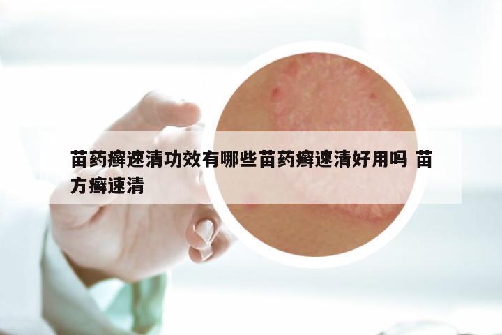 苗药癣速清功效有哪些苗药癣速清好用吗 苗方癣速清