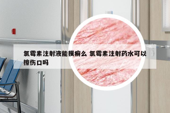 氯霉素注射液能摸癣么 氯霉素注射药水可以擦伤口吗