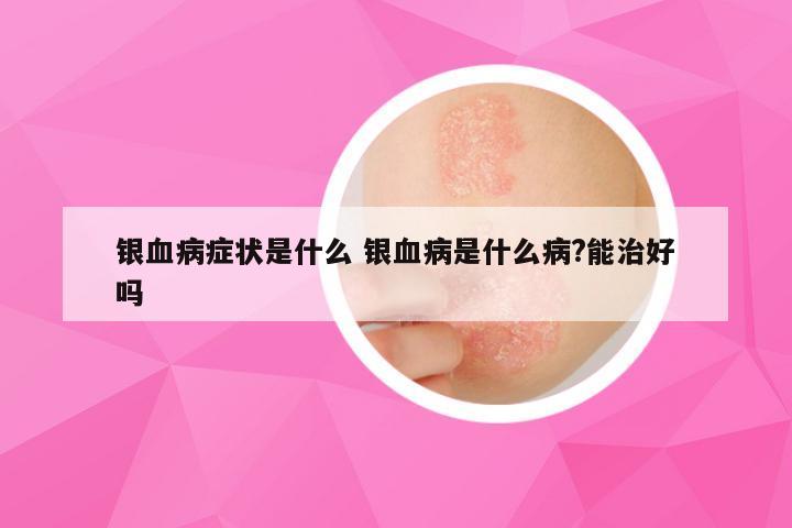 银血病症状是什么 银血病是什么病?能治好吗