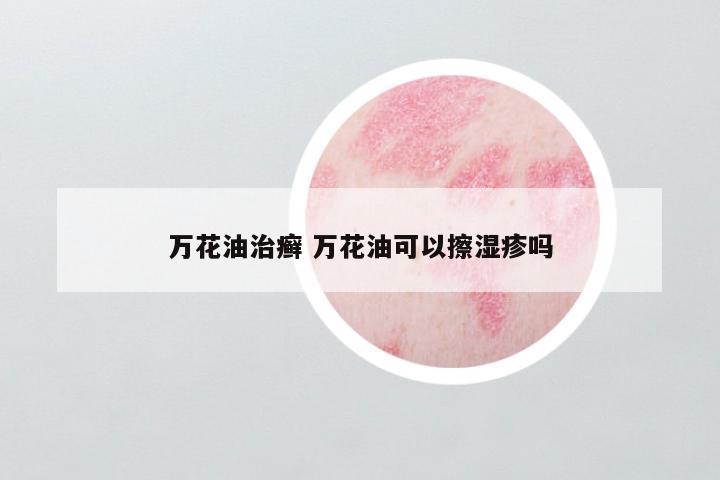 万花油治癣 万花油可以擦湿疹吗
