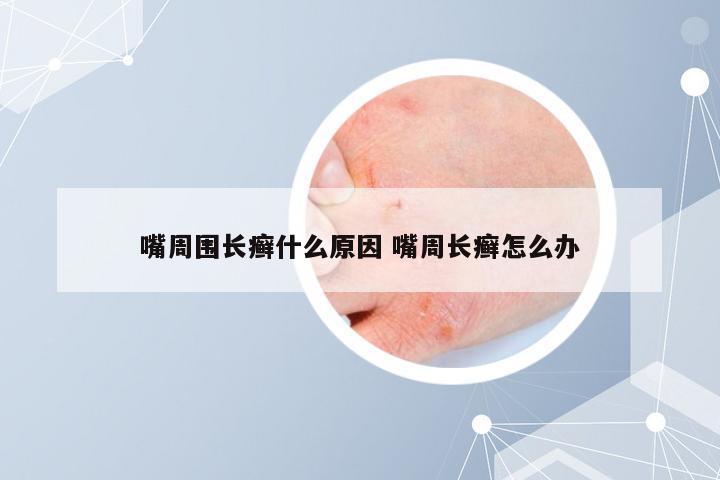 嘴周围长癣什么原因 嘴周长癣怎么办
