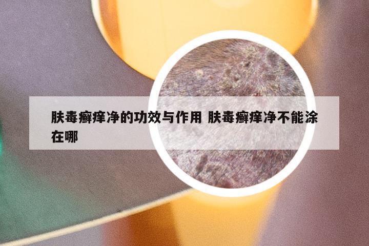 肤毒癣痒净的功效与作用 肤毒癣痒净不能涂在哪