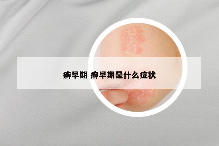 癣早期 癣早期是什么症状