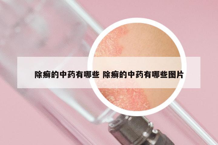 除癣的中药有哪些 除癣的中药有哪些图片