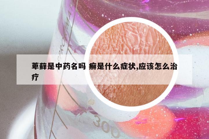 萆藓是中药名吗 癣是什么症状,应该怎么治疗