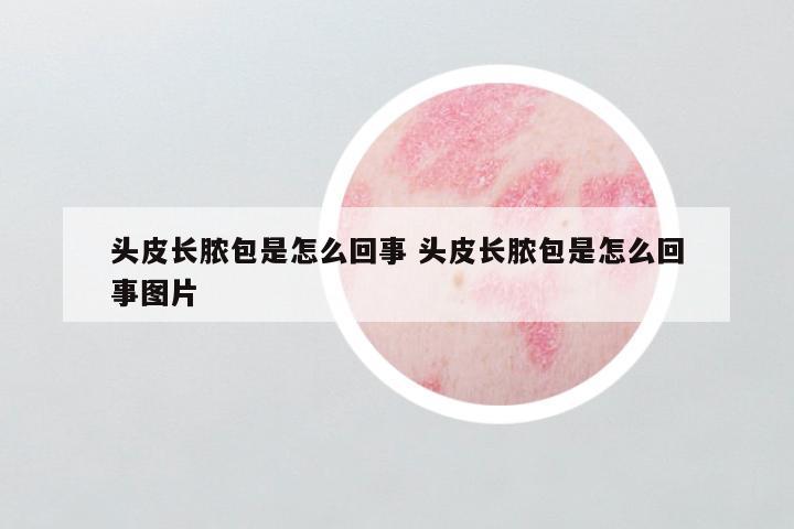 头皮长脓包是怎么回事 头皮长脓包是怎么回事图片