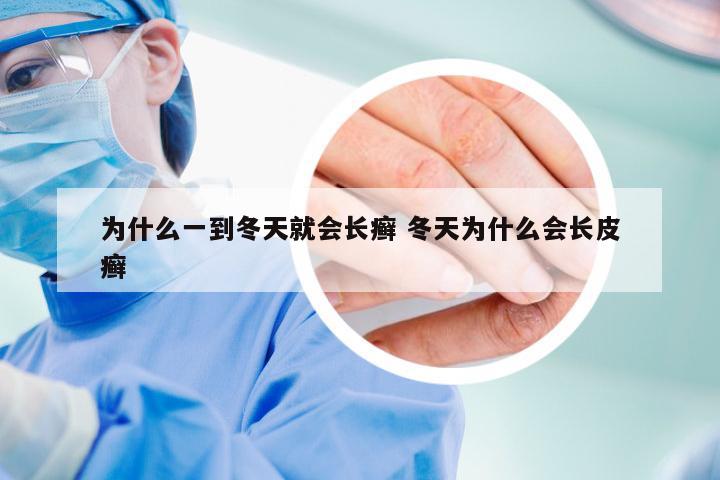 为什么一到冬天就会长癣 冬天为什么会长皮癣