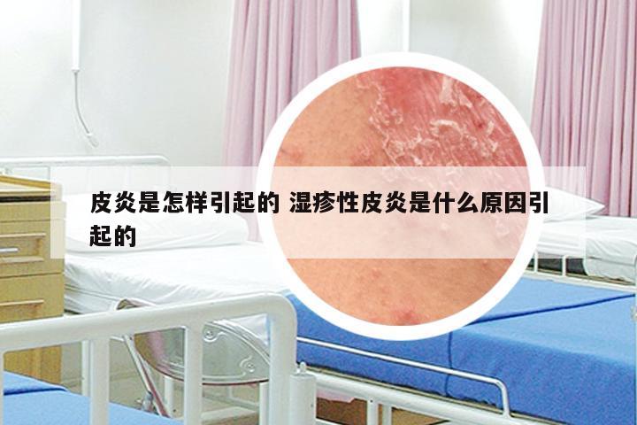 皮炎是怎样引起的 湿疹性皮炎是什么原因引起的