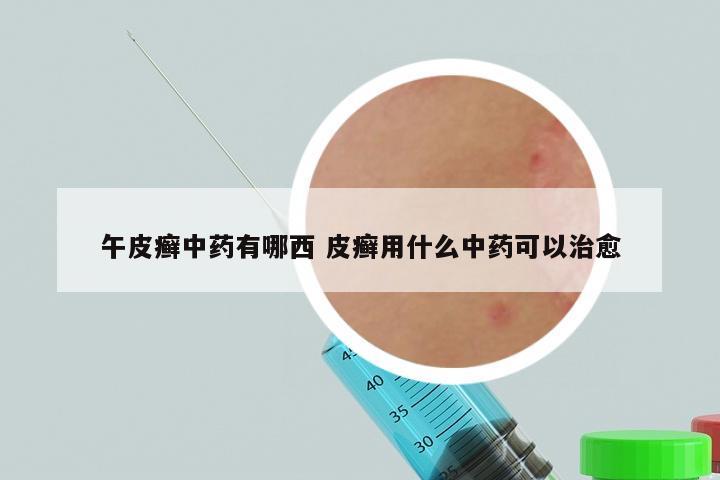 午皮癣中药有哪西 皮癣用什么中药可以治愈