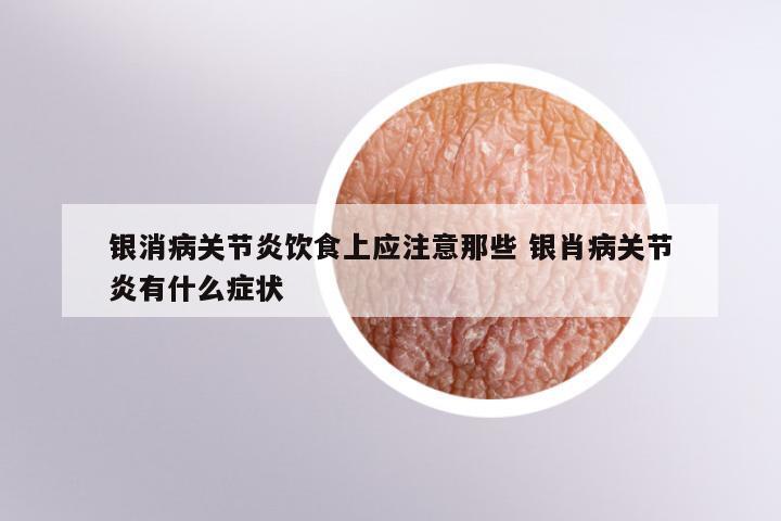银消病关节炎饮食上应注意那些 银肖病关节炎有什么症状