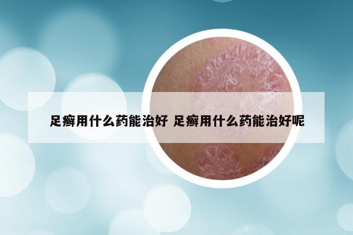 足癣用什么药能治好 足癣用什么药能治好呢