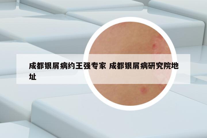 成都银屑病约王强专家 成都银屑病研究院地址