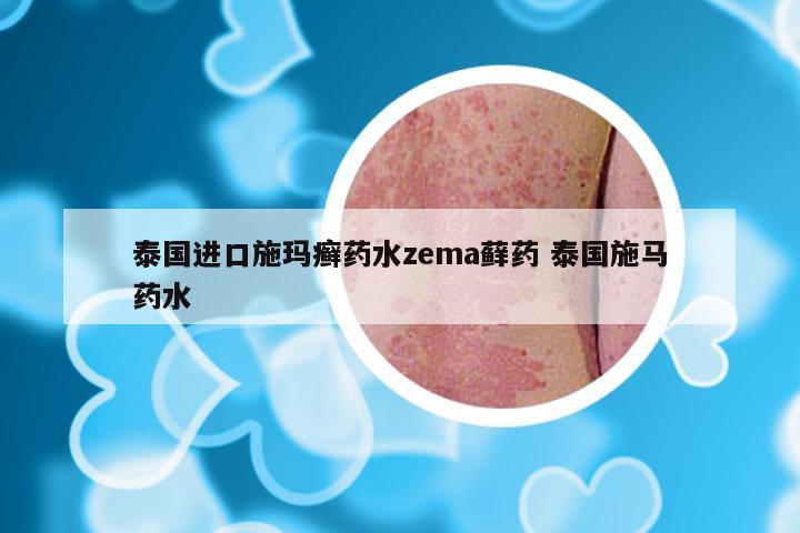 泰国进口施玛癣药水zema藓药 泰国施马药水