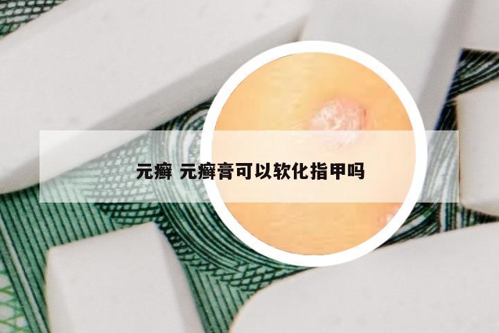 元癣 元癣膏可以软化指甲吗