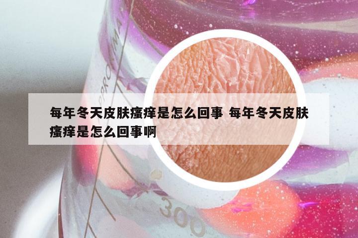 每年冬天皮肤瘙痒是怎么回事 每年冬天皮肤瘙痒是怎么回事啊