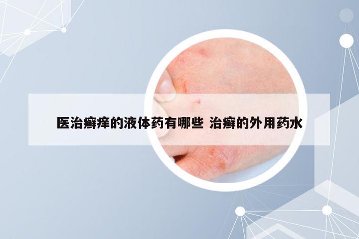 医治癣痒的液体药有哪些 治癣的外用药水