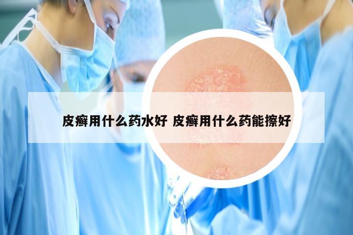 皮癣用什么药水好 皮癣用什么药能擦好