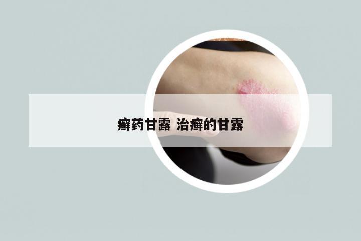 癣药甘露 治癣的甘露