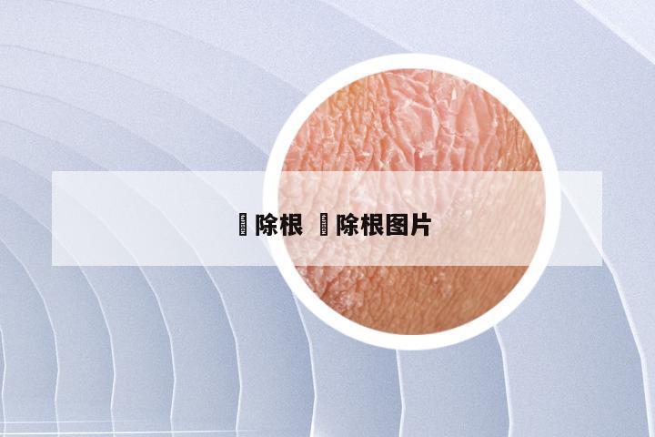 廯除根 廯除根图片